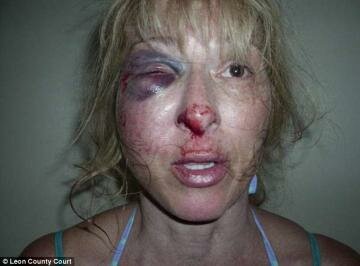 Video Shows Woman Screaming in Horror as Police Officers 'Break Her Cheekbone During Violent DUI Arrest' Video Shows Woman Screaming in Horror as Police Officers 'Break Her Cheekbone During Violent DUI Arrest'